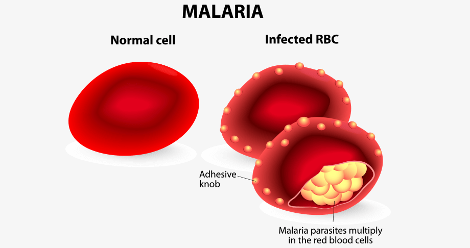 Infected RBC during Malaria